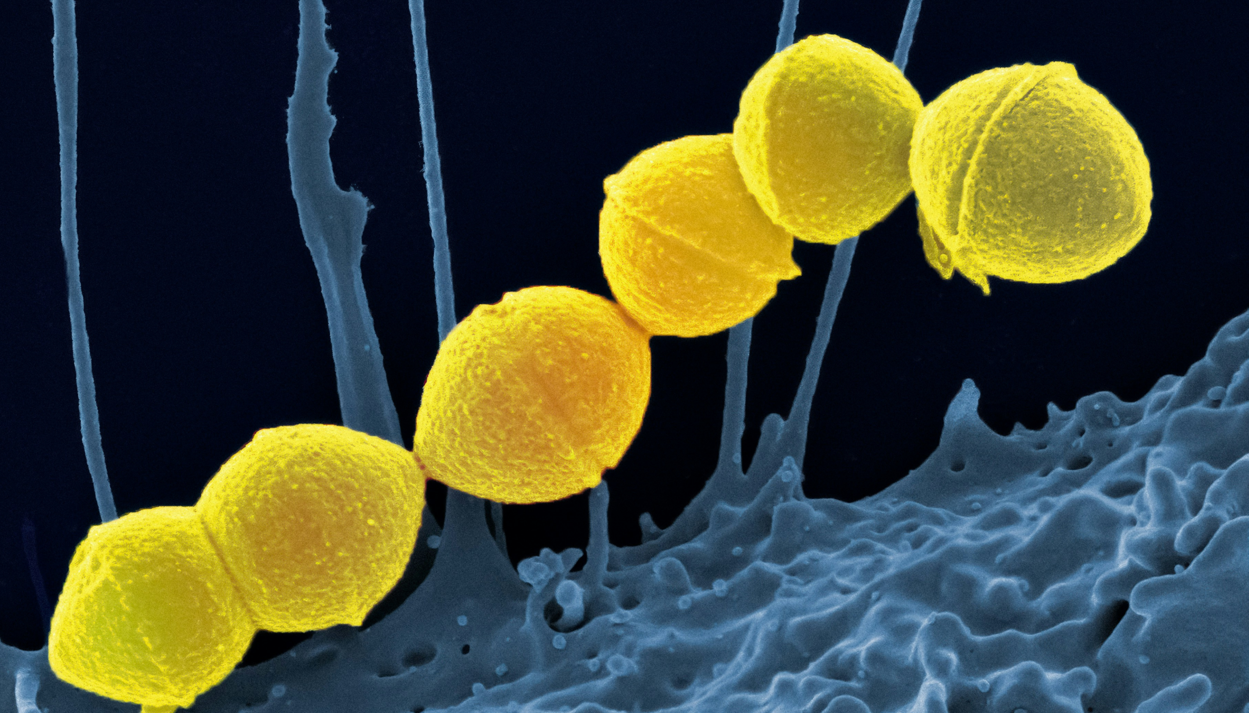 compressed_microbiome